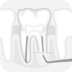 Instrument_R1D_-_Tooth_illustration_Image_001133_00_150dpi.jpg Instrument_R1D_-_Tooth_illustration_Image_001133_00_150dpi.jpg