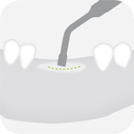 Instrument_B4_-_Tooth_illustration_Image_001125_00_150dpi.jpg Instrument_B4_-_Tooth_illustration_Image_001125_00_150dpi.jpg