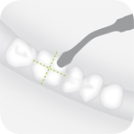 Instrument_B6_-_Tooth_illustration_Image_001127_00_150dpi.jpg Instrument_B6_-_Tooth_illustration_Image_001127_00_150dpi.jpg