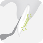 Instrument_EX2_-_Tooth_illustration_Image_001132_00_150dpi.jpg Instrument_EX2_-_Tooth_illustration_Image_001132_00_150dpi.jpg