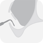 Instrument_S4_-_Tooth_illustration_Image_001142_00_150dpi.jpg Instrument_S4_-_Tooth_illustration_Image_001142_00_150dpi.jpg