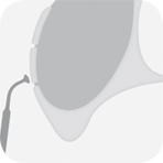 Instrument_S3_-_Tooth_illustration_Image_001141_00_150dpi.jpg
