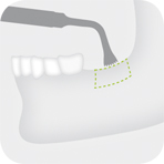 Instrument_B1_-_Tooth_illustration_Image_001122_00_150dpi.jpg Instrument_B1_-_Tooth_illustration_Image_001122_00_150dpi.jpg