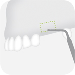 Instrument_S2_-_Tooth_illustration_Image_001140_00_150dpi.jpg Instrument_S2_-_Tooth_illustration_Image_001140_00_150dpi.jpg