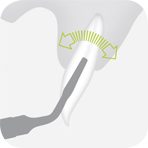 Instrument_EX1_-_Tooth_illustration_Image_001131_00_150dpi.jpg Instrument_EX1_-_Tooth_illustration_Image_001131_00_150dpi.jpg