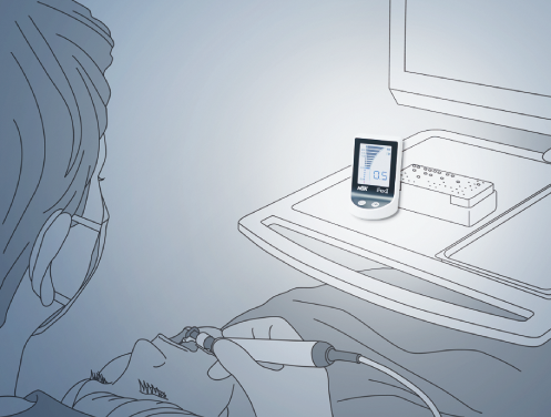 ipex-02.png