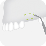 Instrument_S1_-_Tooth_illustration_Image_001139_00_150dpi (1).jpg Instrument_S1_-_Tooth_illustration_Image_001139_00_150dpi (1).jpg