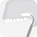 Instrument_B5_-_Tooth_illustration_Image_001126_00_150dpi.jpg Instrument_B5_-_Tooth_illustration_Image_001126_00_150dpi.jpg