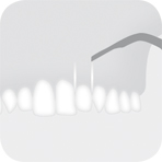 Instrument_B3_-_Tooth_illustration_Image_001124_00_150dpi.jpg Instrument_B3_-_Tooth_illustration_Image_001124_00_150dpi.jpg