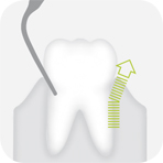 Instrument_P1_-_Tooth_illustration_Image_001128_00_150dpi.jpg Instrument_P1_-_Tooth_illustration_Image_001128_00_150dpi.jpg