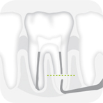 Instrument_R3D_-_Tooth_illustration_Image_001136_00_150dpi.jpg Instrument_R3D_-_Tooth_illustration_Image_001136_00_150dpi.jpg