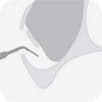 Instrument_S5_-_Tooth_illustration_Image_001143_00_150dpi.jpg